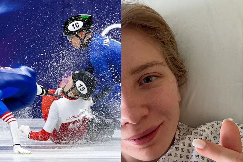 Олимпијката од Полска објави фотографија, откако лицето и беше пресечено со лизгалка на мраз