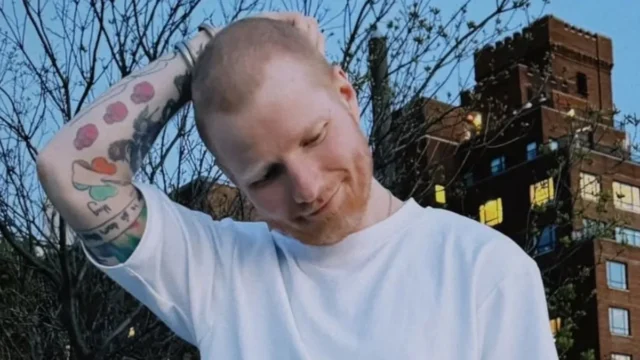 (Foto) Ед Ширан откри дека се бори со херпес поради што морал да ја избричи главата