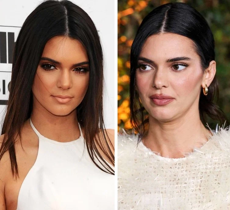 Кендал Џенер ги демантира гласините за операција: „Носот ми се промени од лекови против акни“